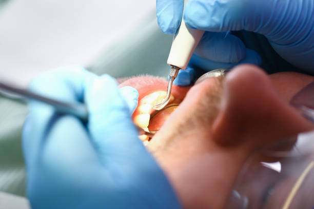 Best Broken Tooth Emergency  in Glennville, GA